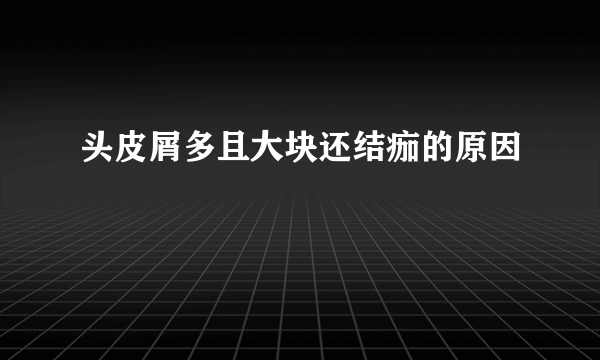 头皮屑多且大块还结痂的原因