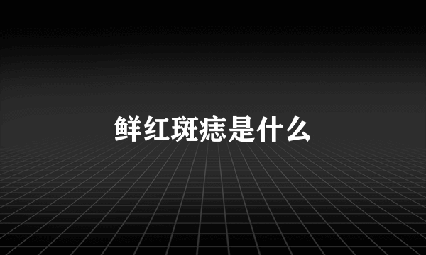 鲜红斑痣是什么