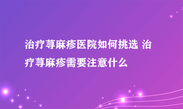 治疗荨麻疹医院如何挑选 治疗荨麻疹需要注意什么