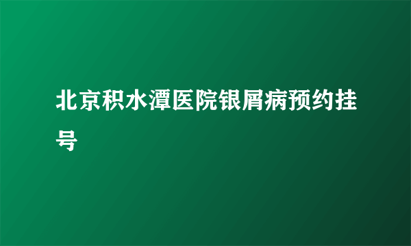 北京积水潭医院银屑病预约挂号