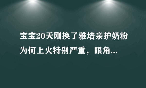 宝宝20天刚换了雅培亲护奶粉为何上火特别严重，眼角发炎，便.