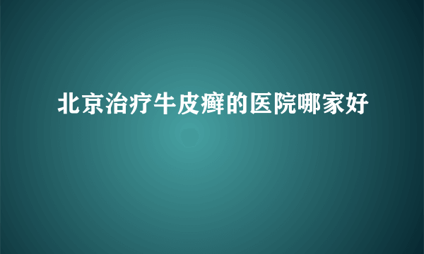 北京治疗牛皮癣的医院哪家好