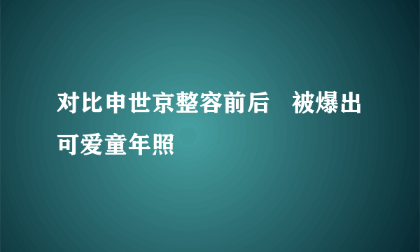 对比申世京整容前后   被爆出可爱童年照