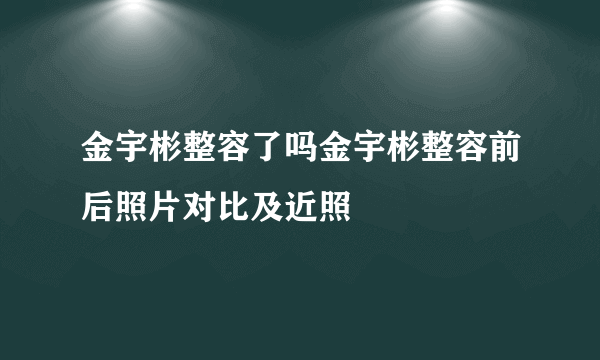 金宇彬整容了吗金宇彬整容前后照片对比及近照