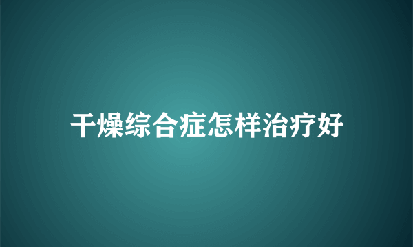 干燥综合症怎样治疗好