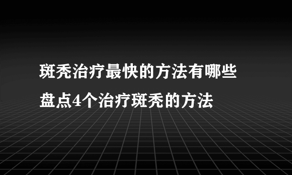 斑秃治疗最快的方法有哪些 盘点4个治疗斑秃的方法