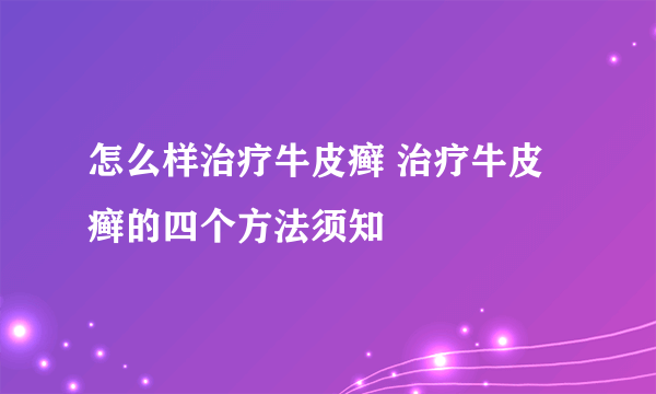 怎么样治疗牛皮癣 治疗牛皮癣的四个方法须知