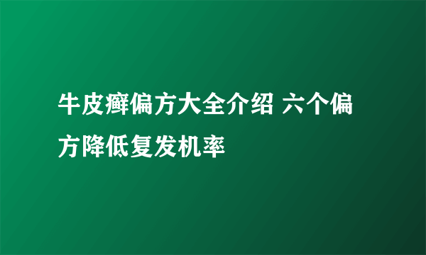 牛皮癣偏方大全介绍 六个偏方降低复发机率