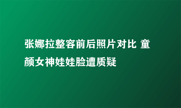 张娜拉整容前后照片对比 童颜女神娃娃脸遭质疑