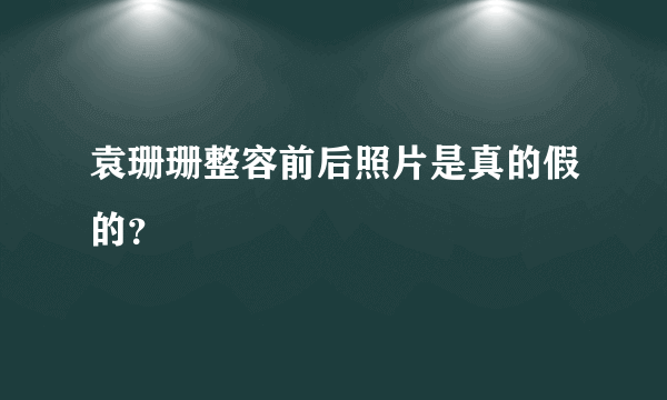 袁珊珊整容前后照片是真的假的？