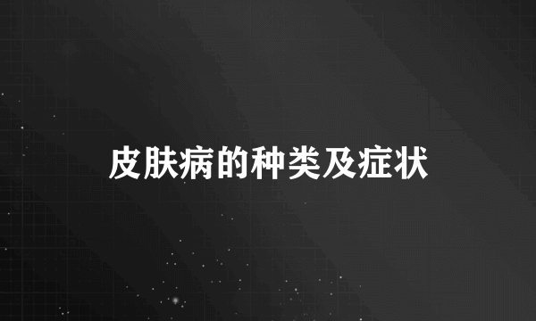 皮肤病的种类及症状