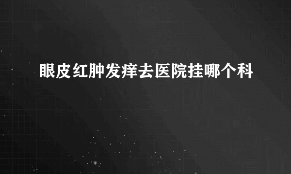 眼皮红肿发痒去医院挂哪个科