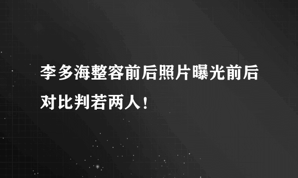 李多海整容前后照片曝光前后对比判若两人！