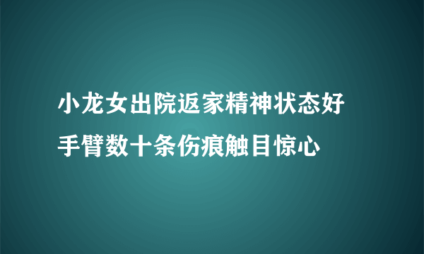 小龙女出院返家精神状态好 手臂数十条伤痕触目惊心