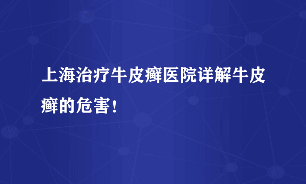 上海治疗牛皮癣医院详解牛皮癣的危害！