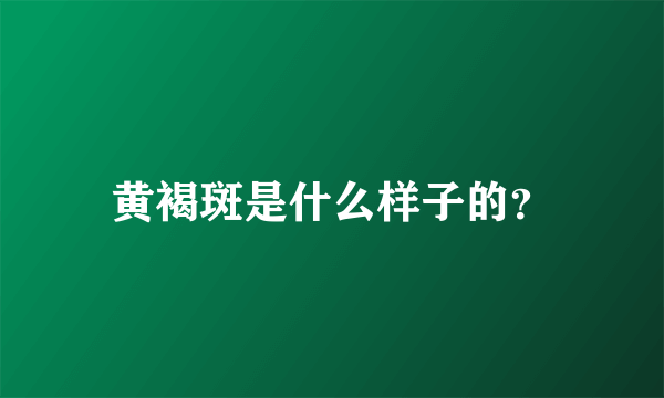 黄褐斑是什么样子的？