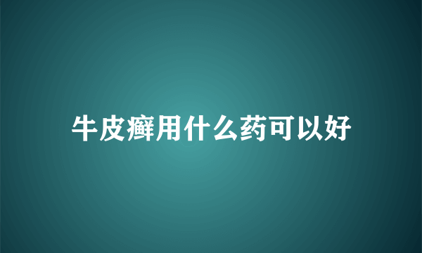 牛皮癣用什么药可以好