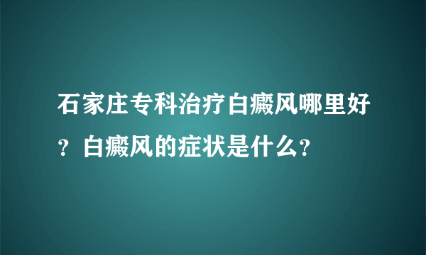 石家庄专科治疗白癜风哪里好？白癜风的症状是什么？