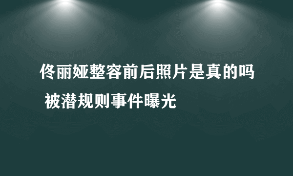 佟丽娅整容前后照片是真的吗 被潜规则事件曝光