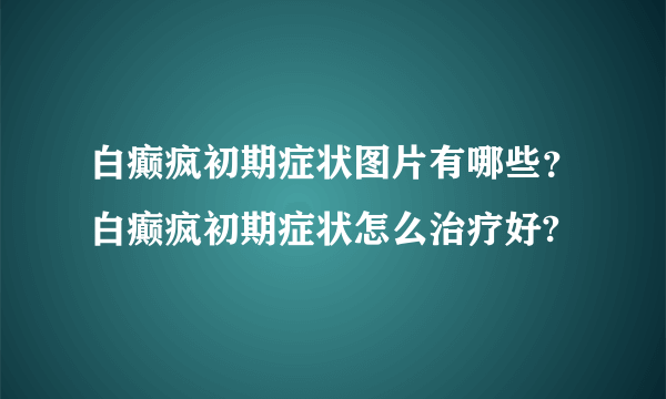 白癫疯初期症状图片有哪些？白癫疯初期症状怎么治疗好?