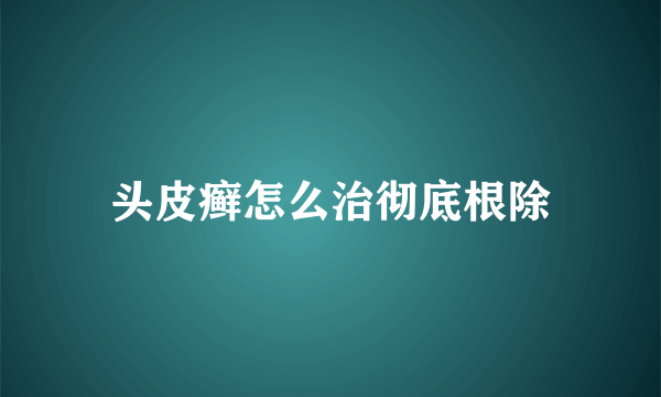 头皮癣怎么治彻底根除