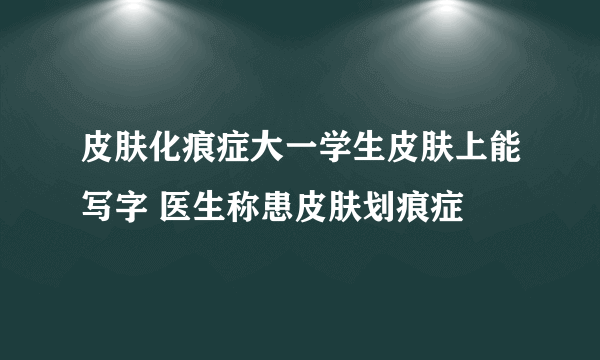 皮肤化痕症大一学生皮肤上能写字 医生称患皮肤划痕症