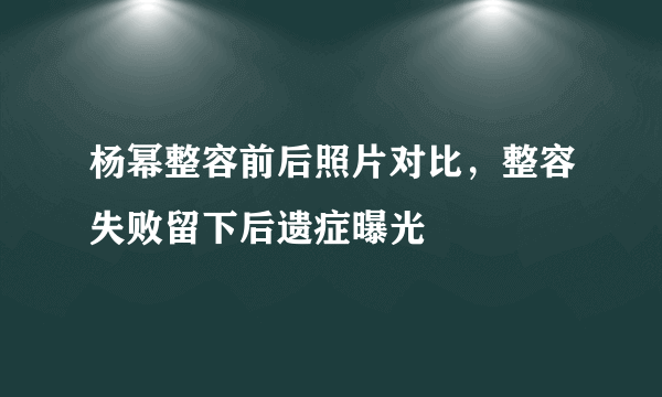 杨幂整容前后照片对比，整容失败留下后遗症曝光