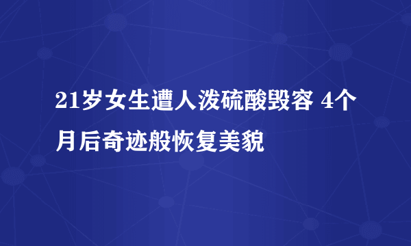 21岁女生遭人泼硫酸毁容 4个月后奇迹般恢复美貌