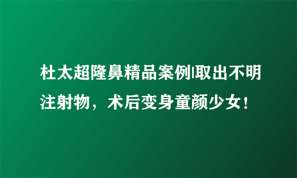 杜太超隆鼻精品案例|取出不明注射物，术后变身童颜少女！