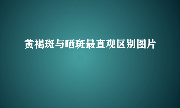 黄褐斑与晒斑最直观区别图片