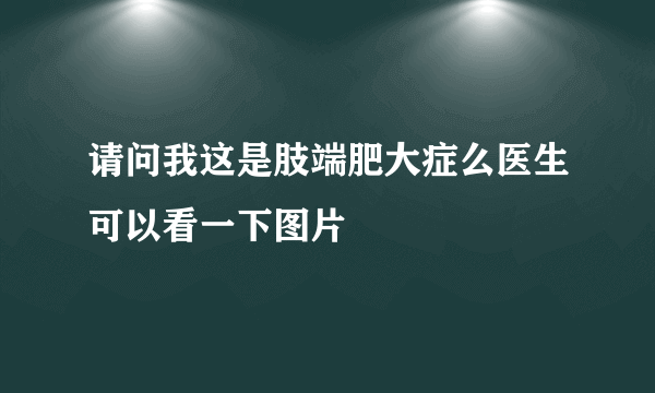 请问我这是肢端肥大症么医生可以看一下图片