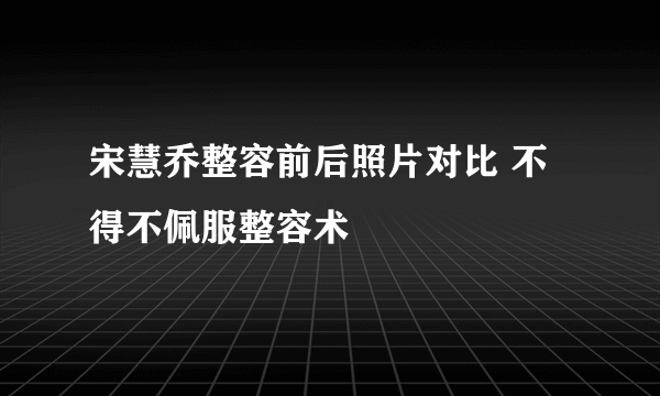 宋慧乔整容前后照片对比 不得不佩服整容术