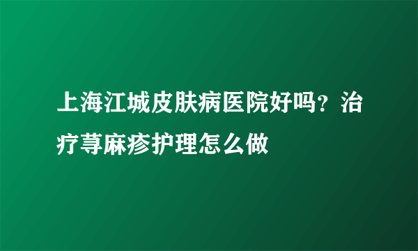 上海江城皮肤病医院好吗？治疗荨麻疹护理怎么做