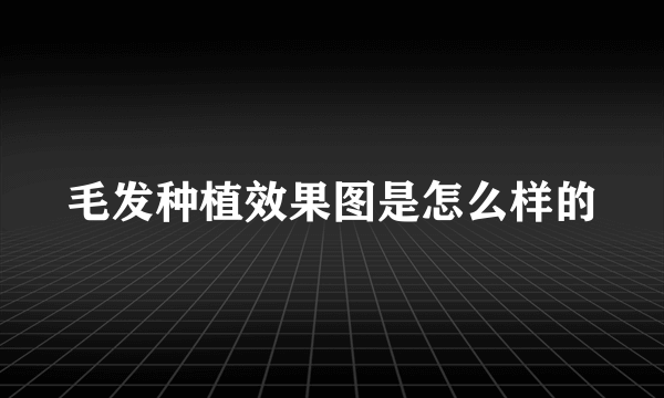 毛发种植效果图是怎么样的