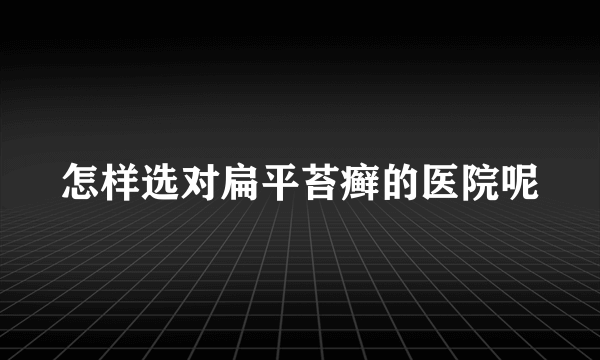 怎样选对扁平苔癣的医院呢