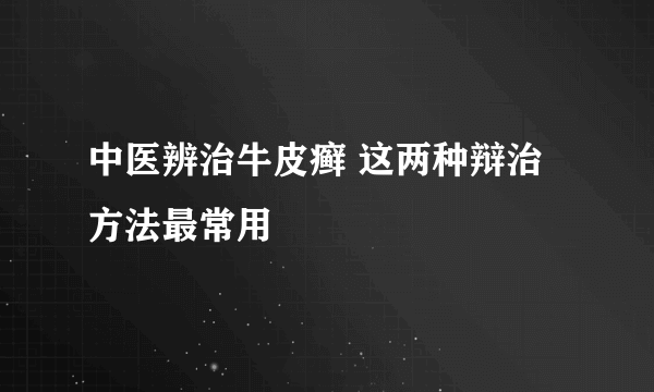 中医辨治牛皮癣 这两种辩治方法最常用