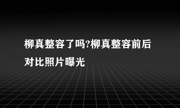 柳真整容了吗?柳真整容前后对比照片曝光