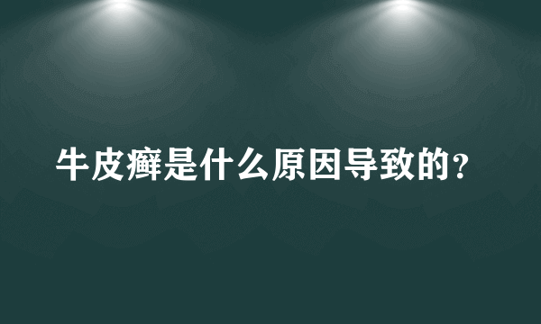 牛皮癣是什么原因导致的？