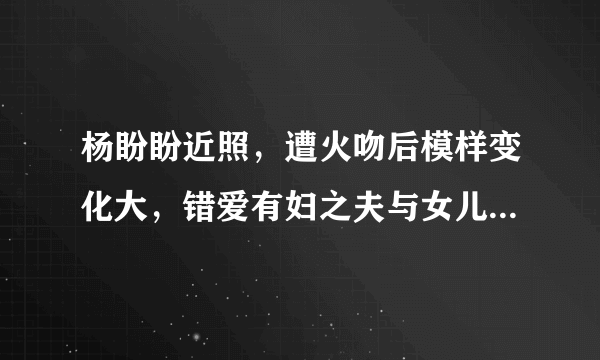 杨盼盼近照，遭火吻后模样变化大，错爱有妇之夫与女儿相依为命