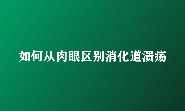 如何从肉眼区别消化道溃疡