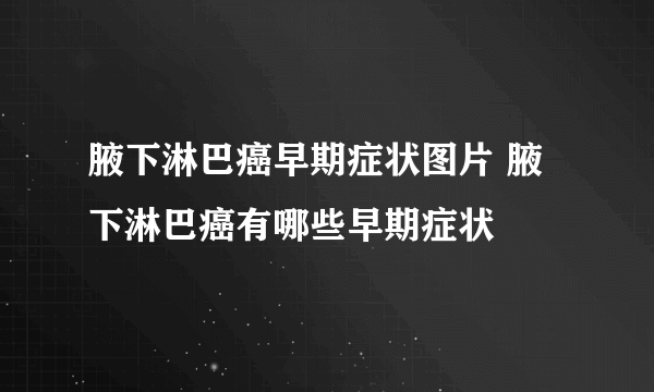 腋下淋巴癌早期症状图片 腋下淋巴癌有哪些早期症状