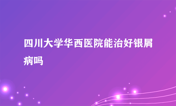 四川大学华西医院能治好银屑病吗