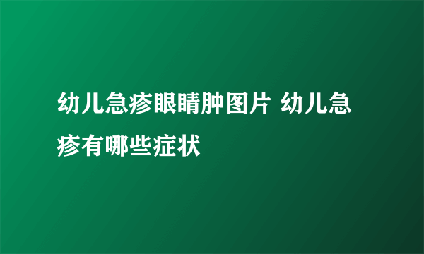 幼儿急疹眼睛肿图片 幼儿急疹有哪些症状