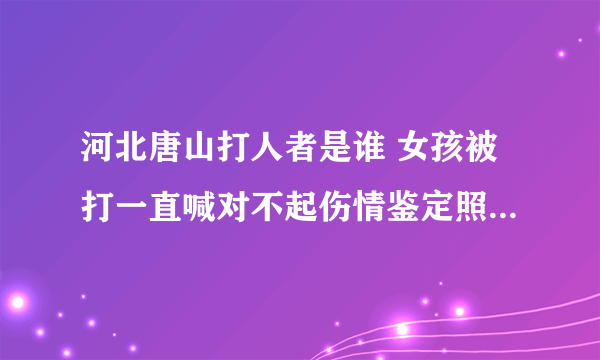 河北唐山打人者是谁 女孩被打一直喊对不起伤情鉴定照片出来了