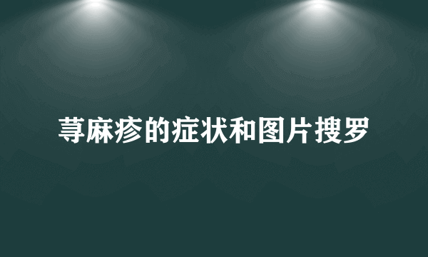 荨麻疹的症状和图片搜罗