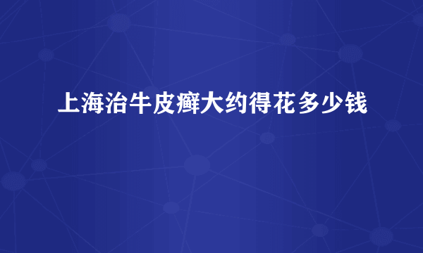 上海治牛皮癣大约得花多少钱