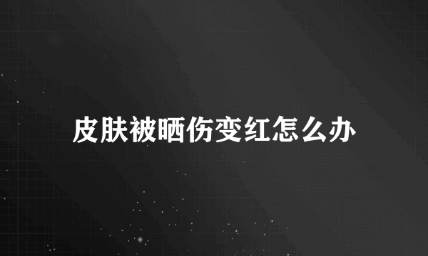 皮肤被晒伤变红怎么办