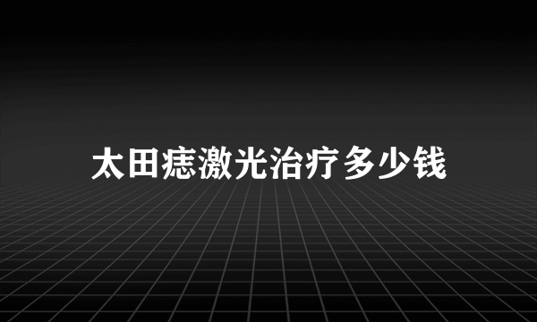 太田痣激光治疗多少钱