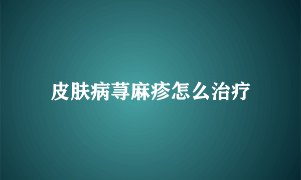 皮肤病荨麻疹怎么治疗