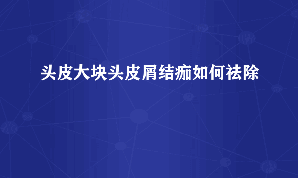 头皮大块头皮屑结痂如何祛除